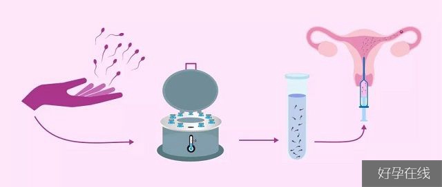 人工授精流程示意