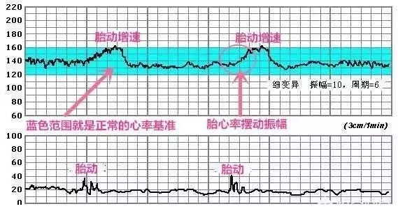 孕期多久能有胎儿心跳