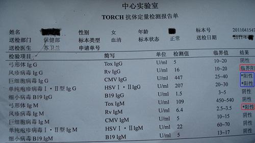 torch检查报告单